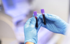 Blood Tests in Jakarta